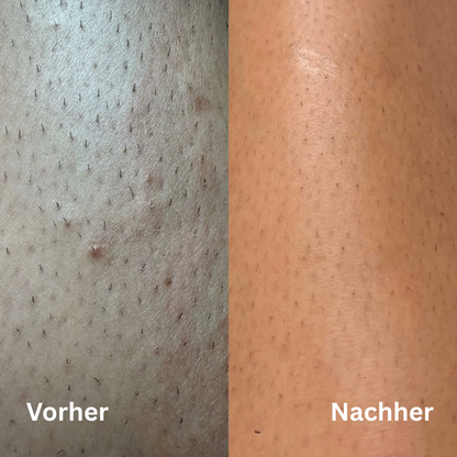 SmoothTrim 2.0 - 3in1 Ganzkörperrasierer